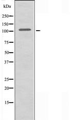 ITPKC Antibody in Western Blot (WB)