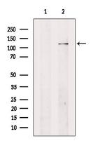 Adenylate Cyclase 4 Antibody in Western Blot (WB)