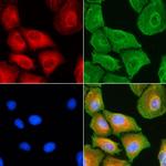 MRPL18 Antibody in Immunocytochemistry (ICC/IF)