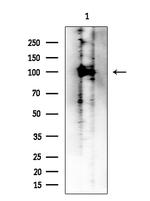 ACSS1 Antibody in Western Blot (WB)