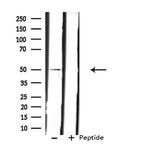 LPCAT2 Antibody in Western Blot (WB)