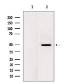 LPCAT2 Antibody in Western Blot (WB)