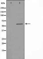 Arylsulfatase F Antibody in Western Blot (WB)