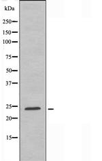 CABP7 Antibody in Western Blot (WB)