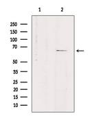 SLC7A4 Antibody in Western Blot (WB)