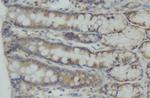 CEP55 Antibody in Immunohistochemistry (Paraffin) (IHC (P))