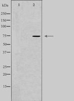 CLCNKA Antibody in Western Blot (WB)