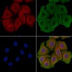 Complement C6 Antibody in Immunocytochemistry (ICC/IF)