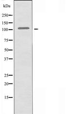 Complement C6 Antibody in Western Blot (WB)