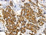 Folate Receptor alpha Antibody in Immunohistochemistry (Paraffin) (IHC (P))