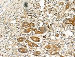 Folate Receptor alpha Antibody in Immunohistochemistry (Paraffin) (IHC (P))