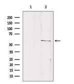 SLC16A2 Antibody in Western Blot (WB)