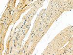 MYH14 Antibody in Immunohistochemistry (Paraffin) (IHC (P))