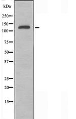 NACAD Antibody in Western Blot (WB)