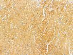 Protein C Inhibitor Antibody in Immunohistochemistry (Paraffin) (IHC (P))