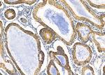 KCNK1 Antibody in Immunohistochemistry (Paraffin) (IHC (P))