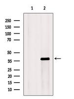 KCNK1 Antibody in Western Blot (WB)