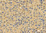 KCNK4 Antibody in Immunohistochemistry (Paraffin) (IHC (P))