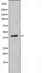 APOBEC3D/APOBEC3F Antibody in Western Blot (WB)