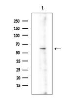 ARHGEF7 Antibody in Western Blot (WB)