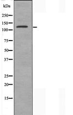 SHANK2 Antibody in Western Blot (WB)