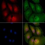 BCL7A Antibody in Immunocytochemistry (ICC/IF)