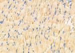 ACTBL2 Antibody in Immunohistochemistry (Paraffin) (IHC (P))