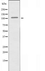FCRL5 Antibody in Western Blot (WB)