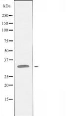 CCRD6 Antibody in Western Blot (WB)