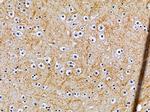 OR10G7 Antibody in Immunohistochemistry (Paraffin) (IHC (P))