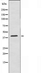 Cytomegalovirus US28 Antibody in Western Blot (WB)