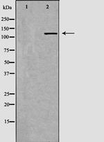 PIK3CG Antibody in Western Blot (WB)