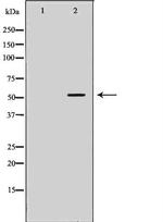 STEAP3 Antibody in Western Blot (WB)