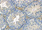 ATG13 Antibody in Immunohistochemistry (Paraffin) (IHC (P))