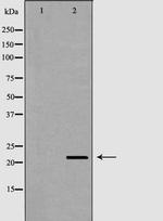 RNase11 Antibody in Western Blot (WB)