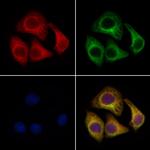 NAT1 Antibody in Immunocytochemistry (ICC/IF)