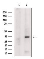 NAT1 Antibody in Western Blot (WB)