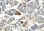 IL-6R Antibody in Immunohistochemistry (Paraffin) (IHC (P))