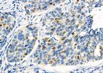 KPNA2 Antibody in Immunohistochemistry (Paraffin) (IHC (P))