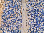 LOX-1 Antibody in Immunohistochemistry (Paraffin) (IHC (P))