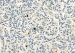 CD162 Antibody in Immunohistochemistry (Paraffin) (IHC (P))