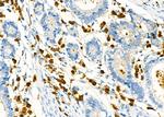 CD162 Antibody in Immunohistochemistry (Paraffin) (IHC (P))