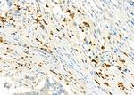 CD162 Antibody in Immunohistochemistry (Paraffin) (IHC (P))