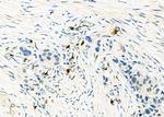 CD162 Antibody in Immunohistochemistry (Paraffin) (IHC (P))