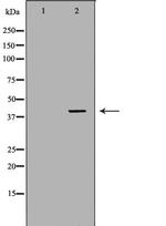 Cathepsin K Antibody in Western Blot (WB)