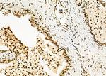 POLI Antibody in Immunohistochemistry (Paraffin) (IHC (P))