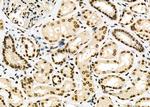 POLI Antibody in Immunohistochemistry (Paraffin) (IHC (P))