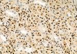 POLI Antibody in Immunohistochemistry (Paraffin) (IHC (P))