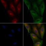 UBE2D1 Antibody in Immunocytochemistry (ICC/IF)