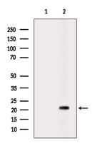 CD94 Antibody in Western Blot (WB)